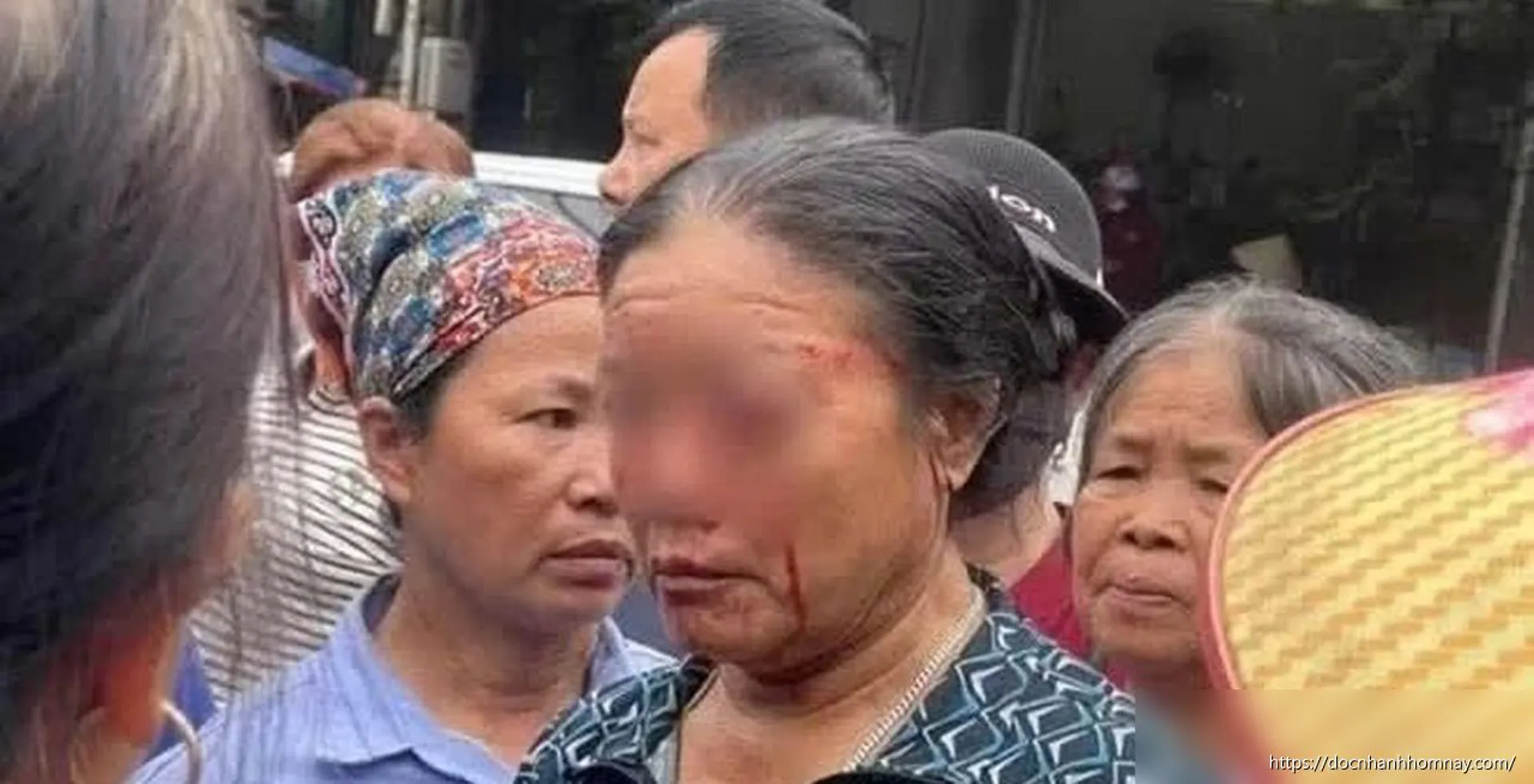 Cần xử lý nghiêm vụ xịt nước người bán rau ở Phú Thọ gây tổn thương mắt
