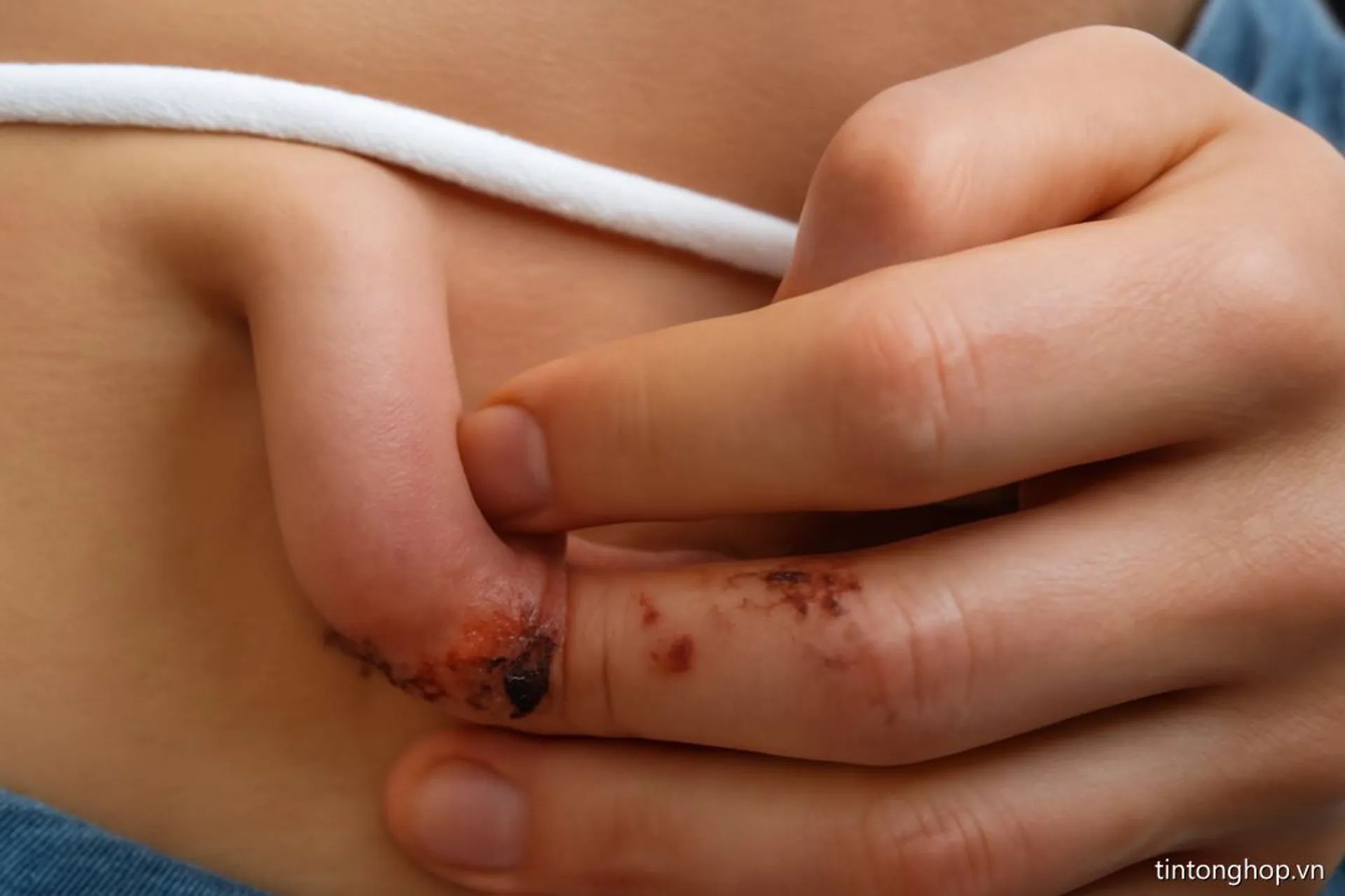 Ngón tay mọc từ bụng: Câu chuyện kỳ lạ của chàng thợ mộc 20 tuổi