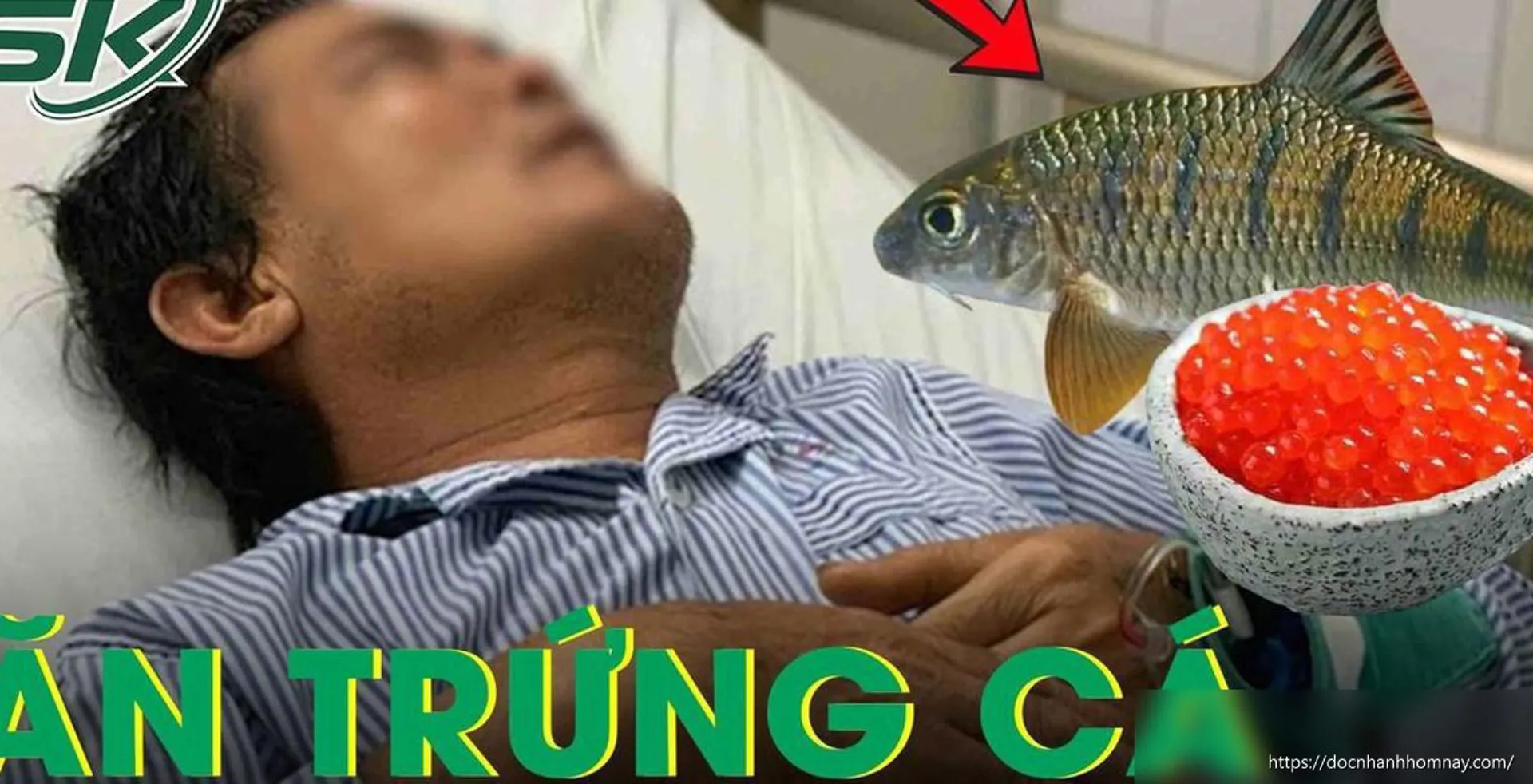 Nguy hiểm tiềm ẩn: Người đàn ông 45 tuổi suýt mất mạng vì ăn trứng cá chép
