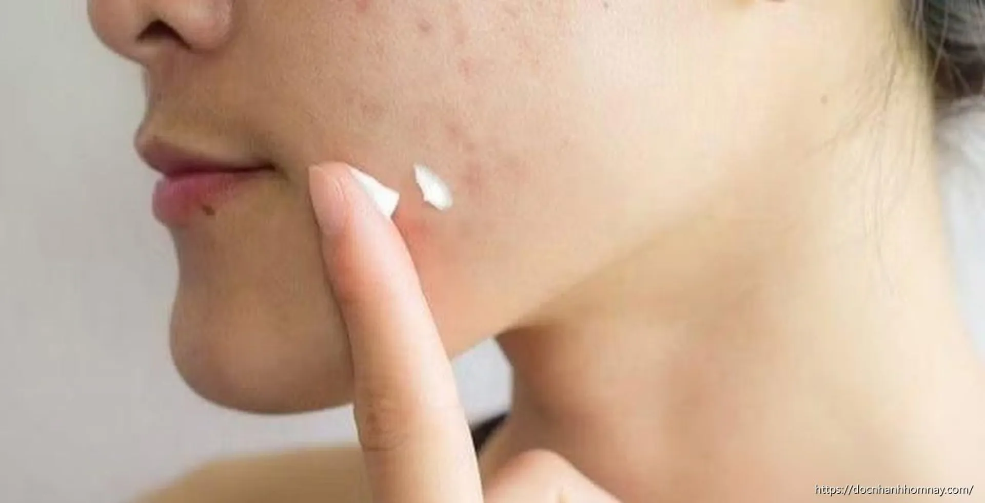 Thu hồi và tiêu hủy 5 loại mỹ phẩm chăm sóc da của Kencare Việt Nam